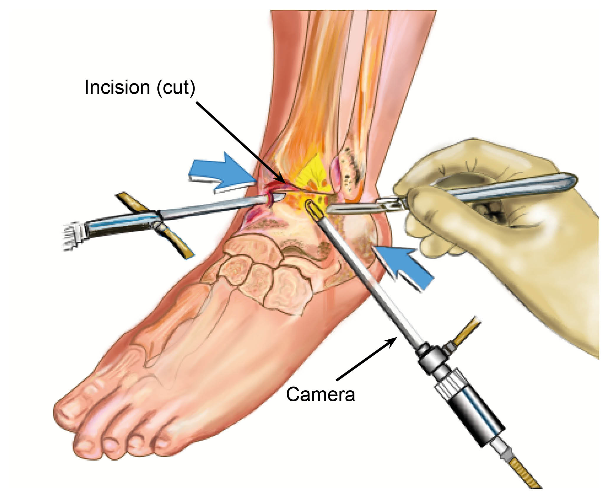 ankle-arthroscopy.jpg