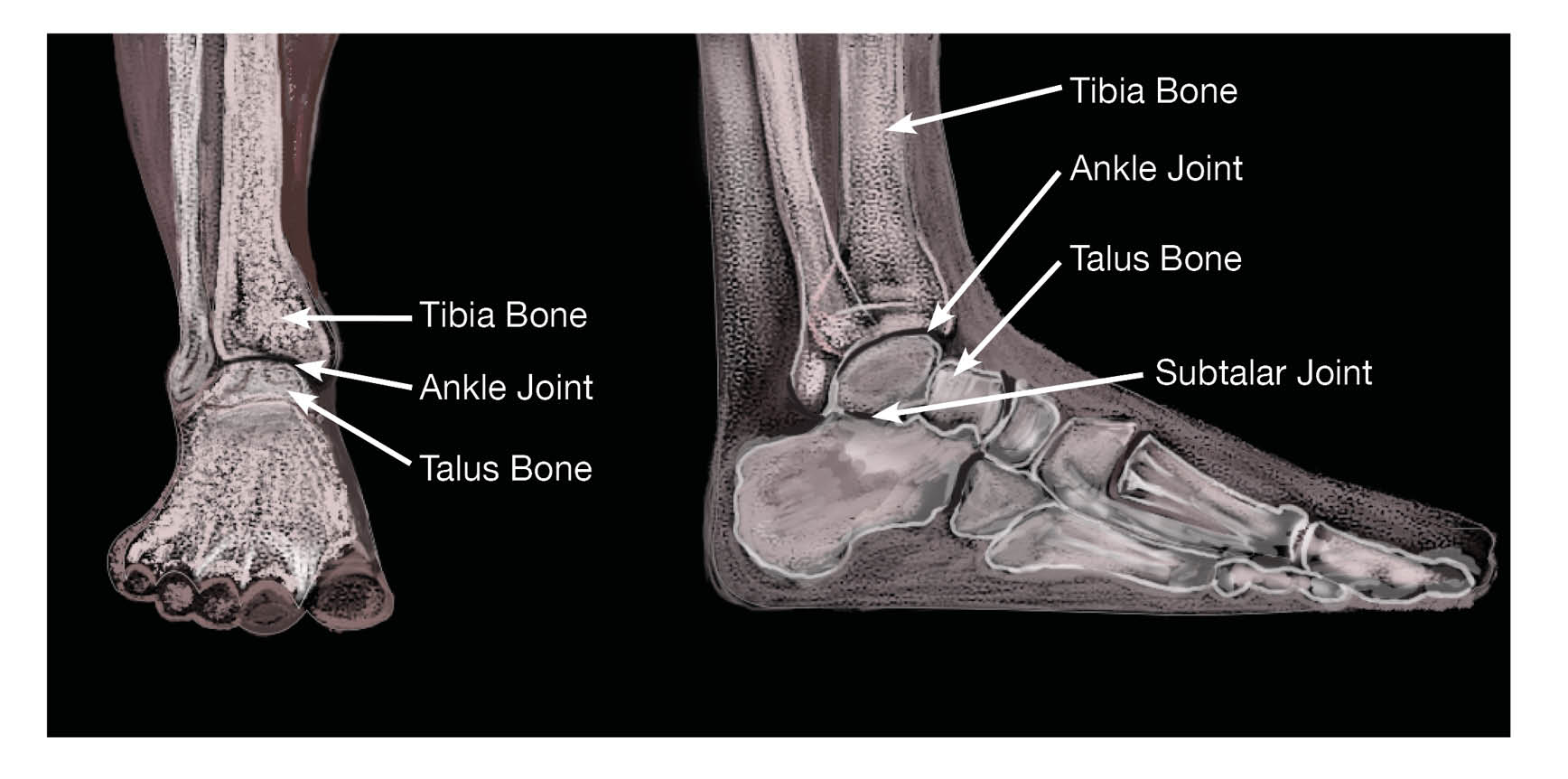 X-ray of the front-side view of a foot, and the sideways view of a foot.