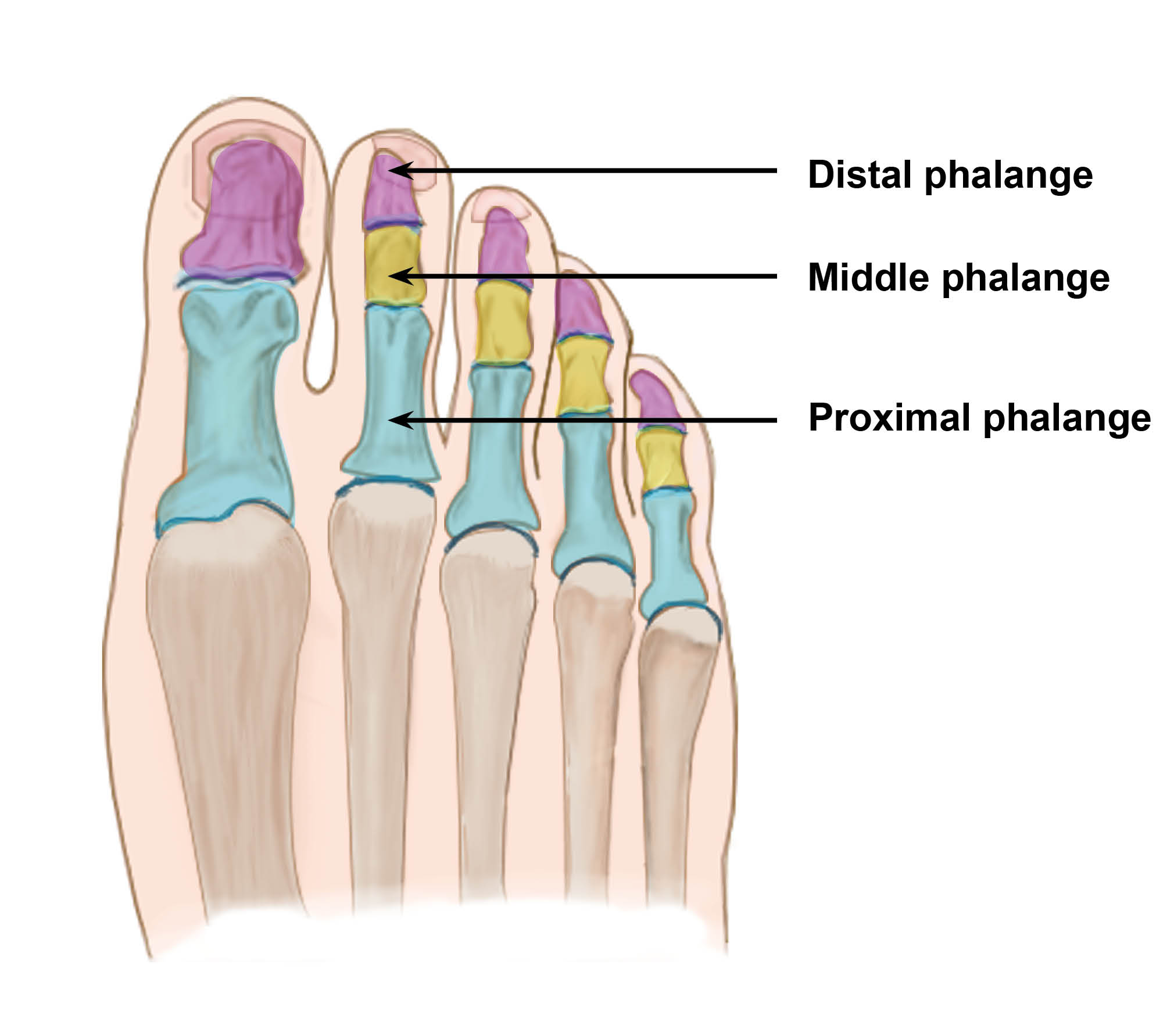 The small bones (phalanges) in the foot