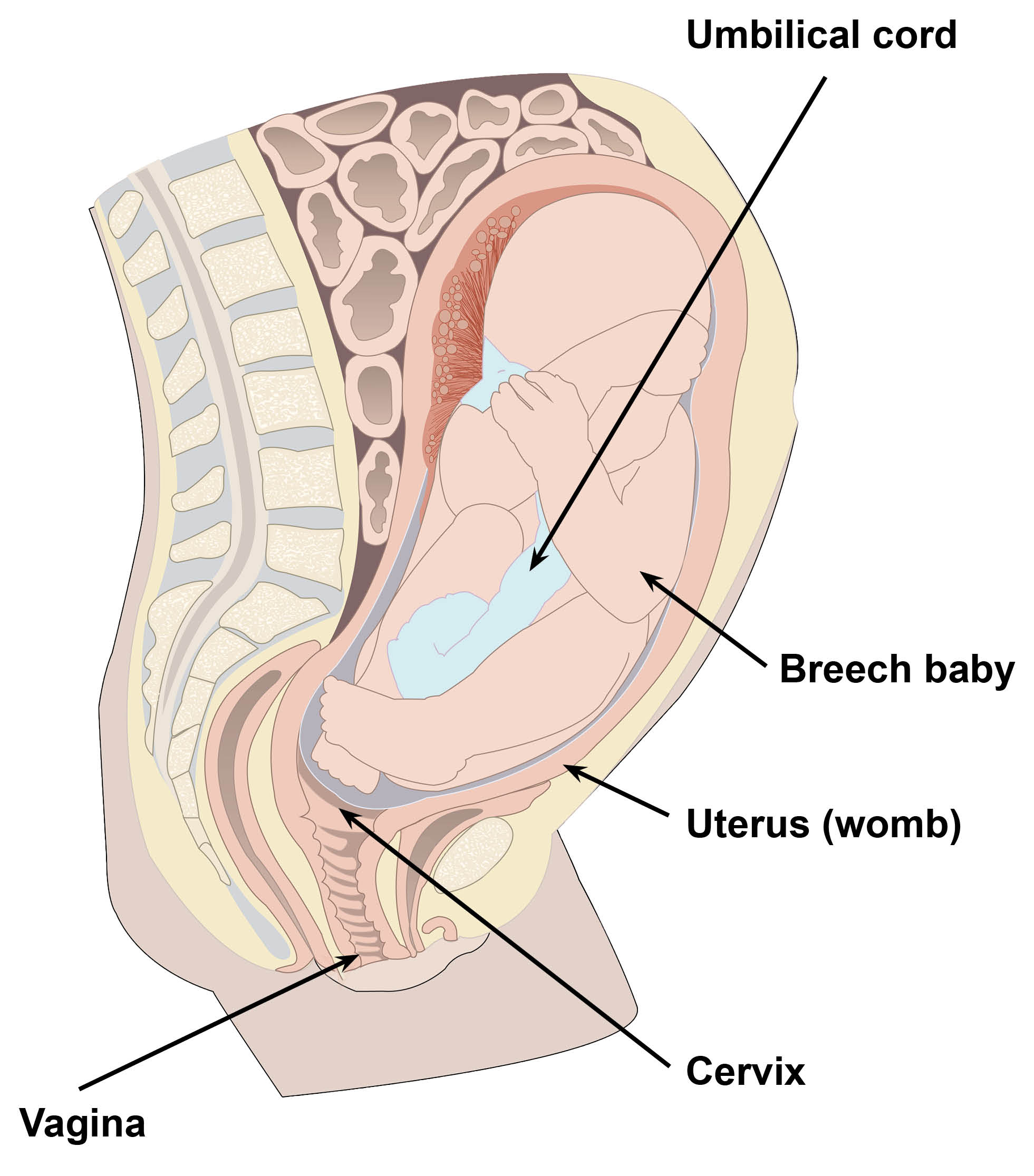 Baby in uterus in a bottom down position