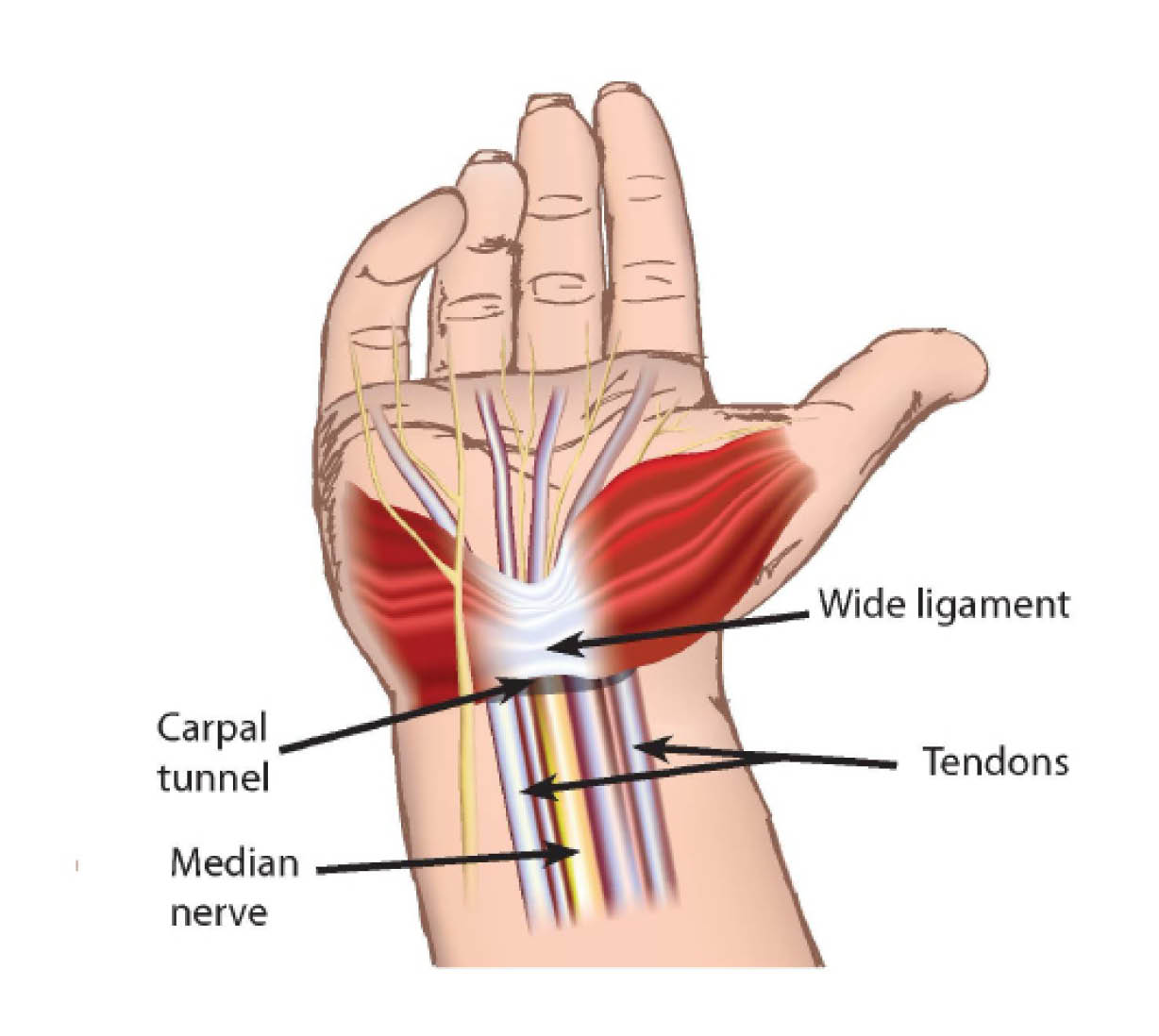 The carpal tunnel, and its surrounding ligaments, nerves, and tendons