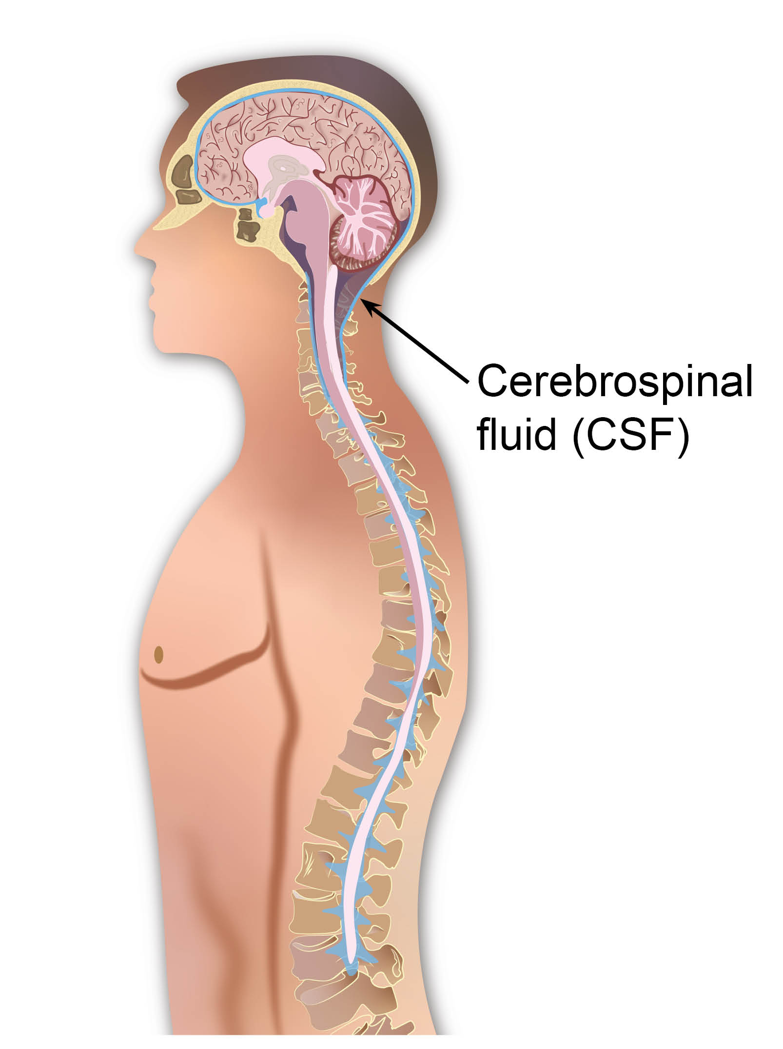 Cerebrospinal fluid surrounding the outside of the brain.