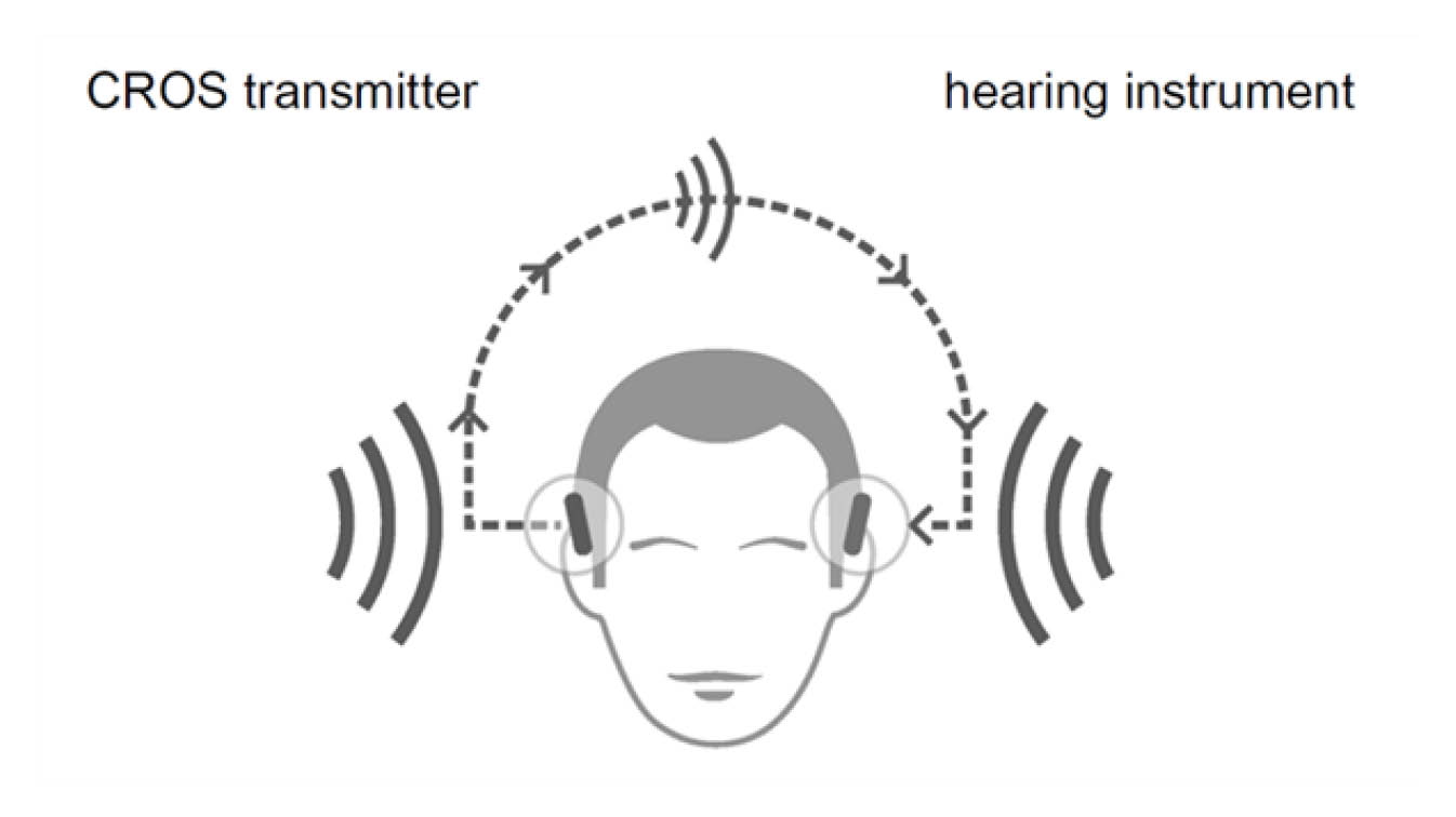 cros-transmitter-and-hearing-instrument.jpg