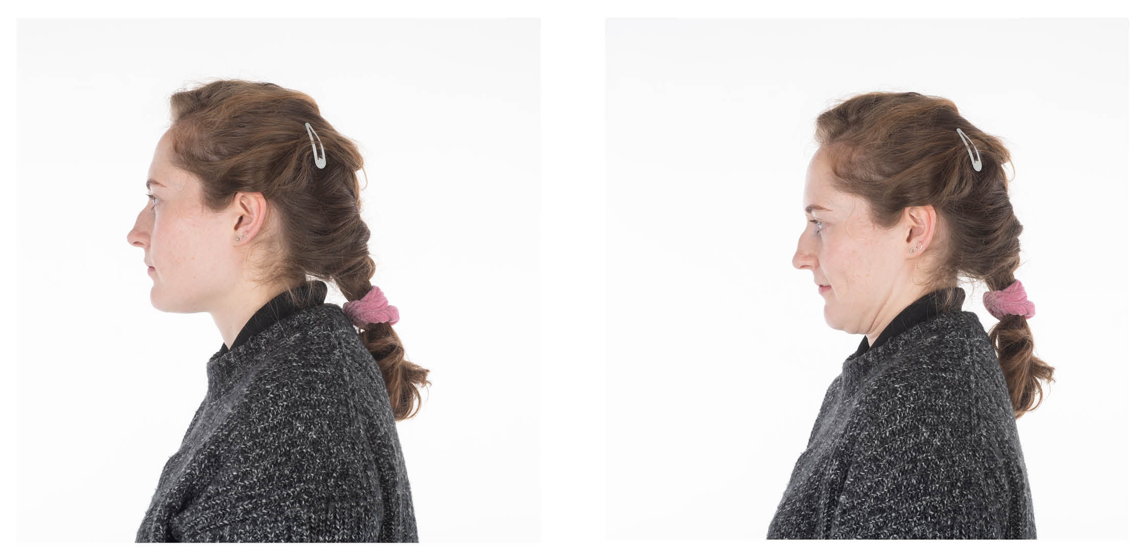 Someone demonstrating the deep neck flexion exercise