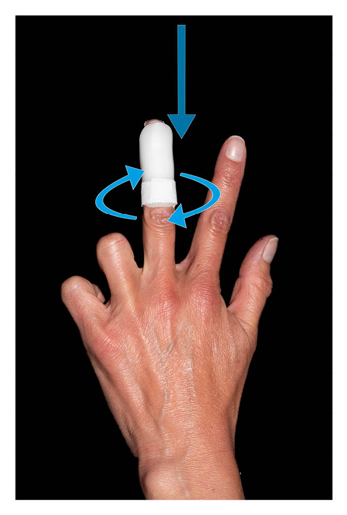 Photo showing the splint in place with the tape applied around the base.