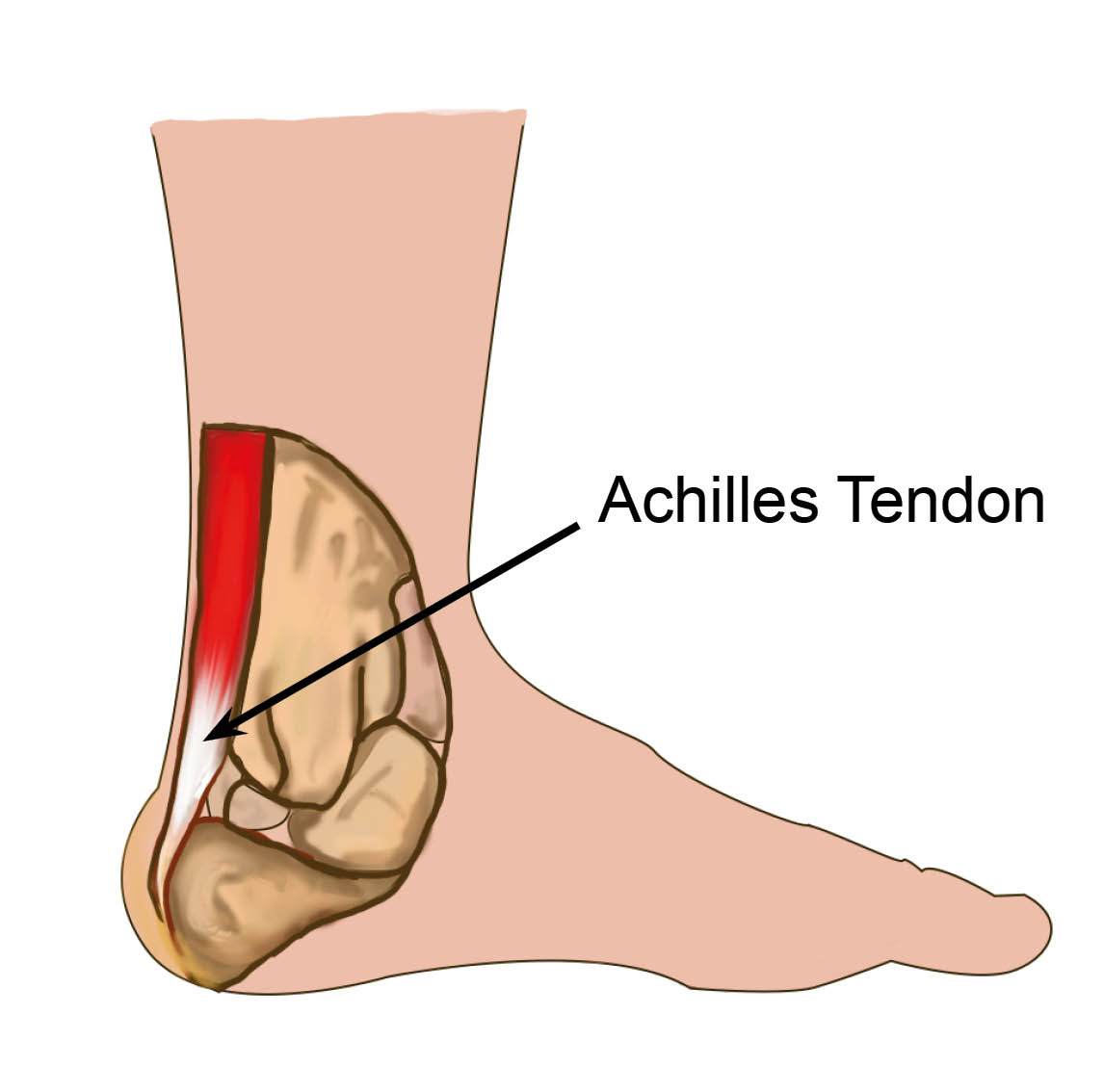 Diagram showing the Achilles Tendon, a fibrous band of tissue that links the muscles in your calf to your heel.