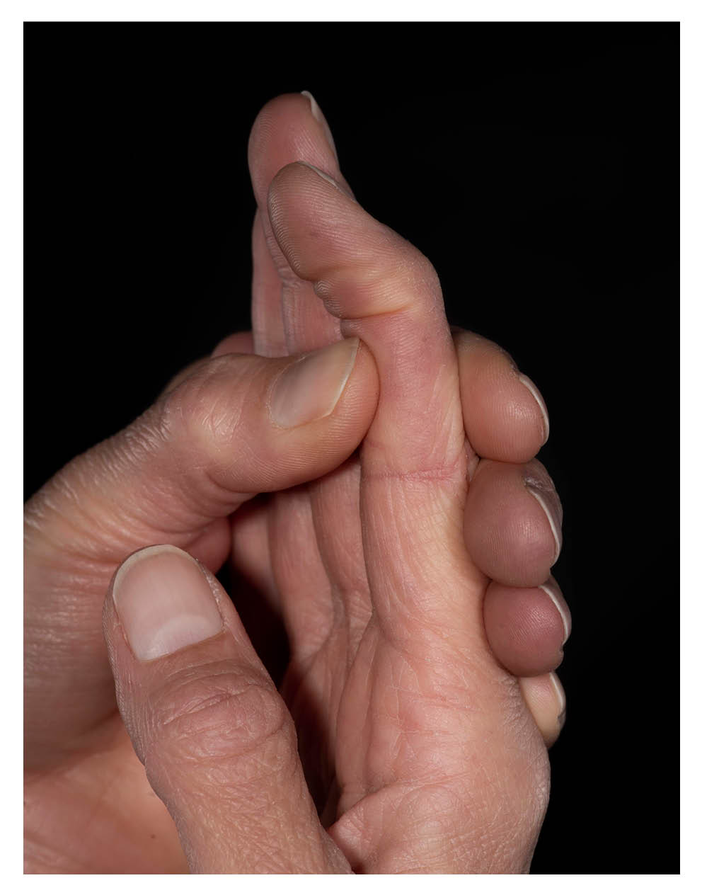 bend-tip-of-finger.jpg