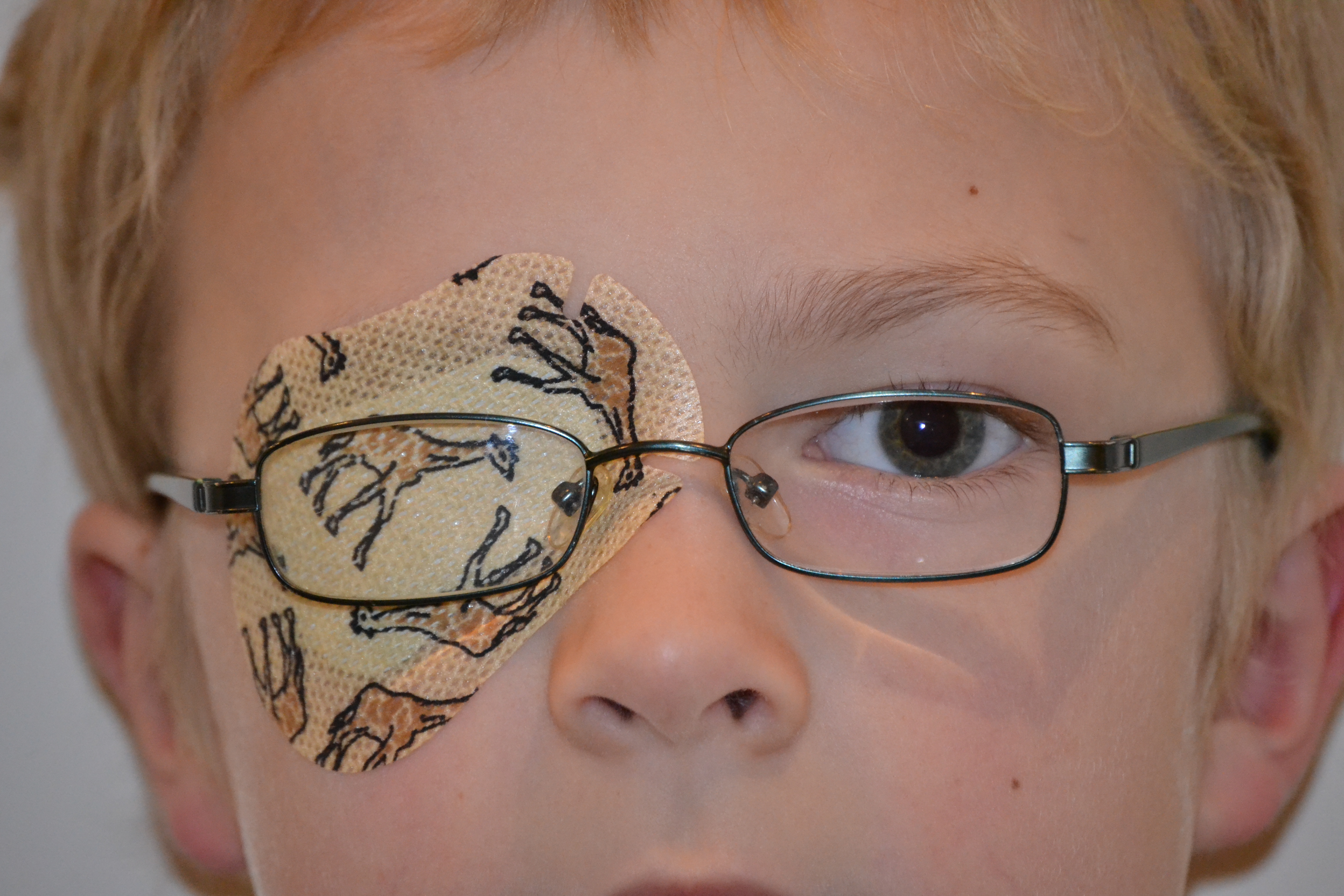 A young child wearing glasses, and a patch with drawings of giraffes on