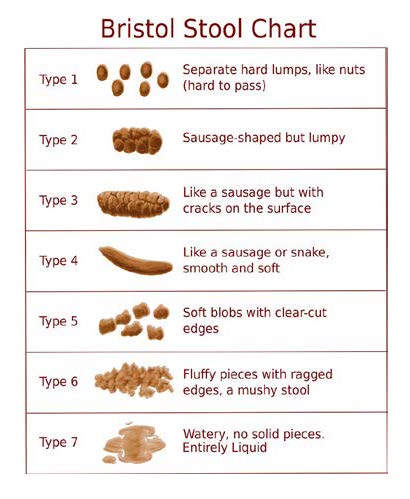 Bristol Stool Chart. Type 1, separate hard lumps, like nuts (hard to pass). Type 2, sausage-shaped but lumpy. Type 3, like a sausage but with cracks on the surface. Type 4, like a sausage or snake, smooth and soft. Type 5, soft blobs with clear-cut edges. Type 6, fluffy pieces with ragged edges, a mushy stool. Type 7, watery, no solid pieces, entirely liquid.