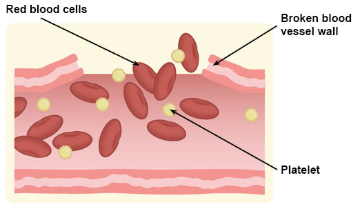 Diagram showing red blood cells and platelets leaking out of a broken blood vessel wall