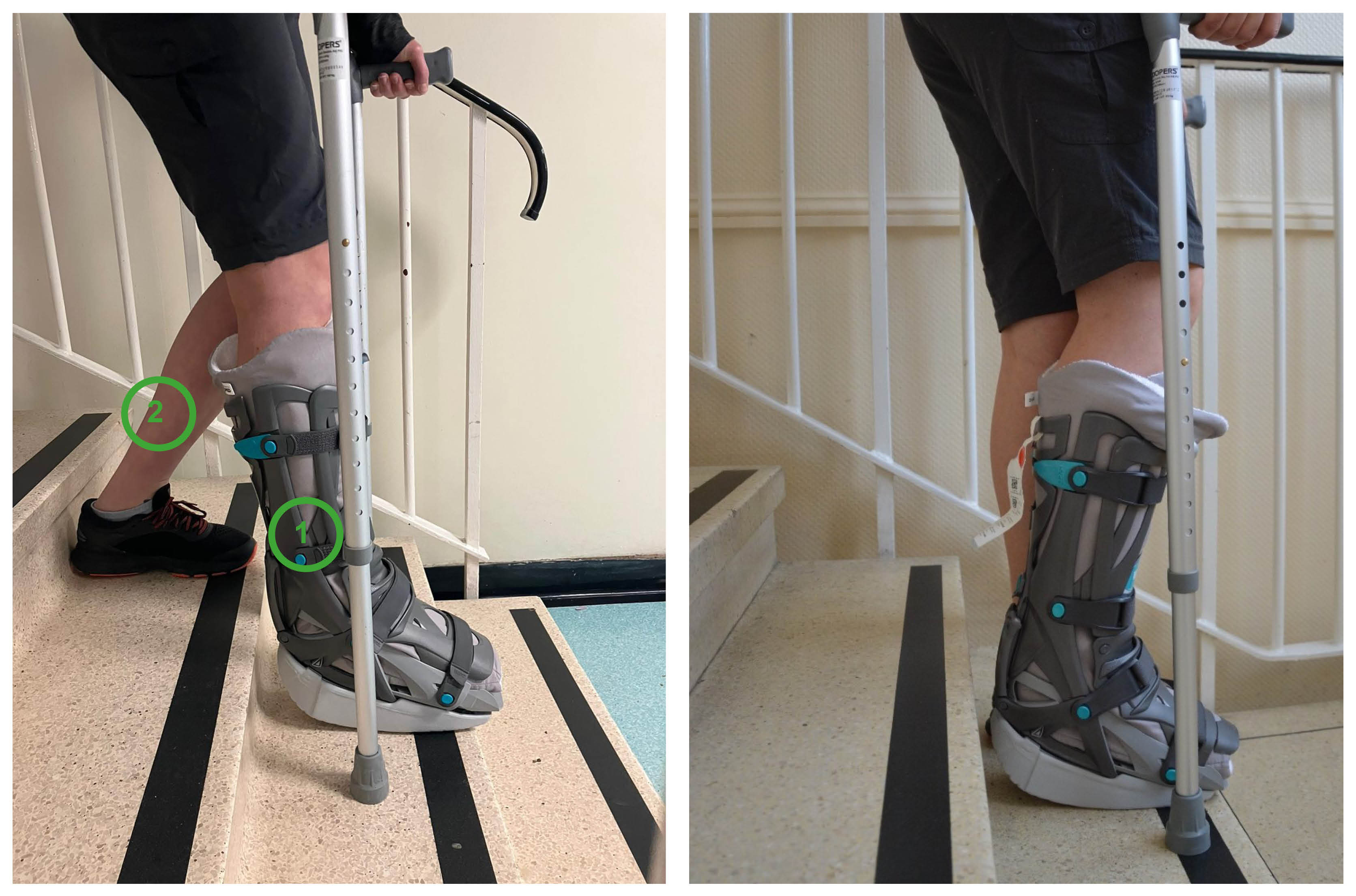 When going down the stairs, you should first put the crutches down, then your affected leg (1) and finally your non-affected leg (2).