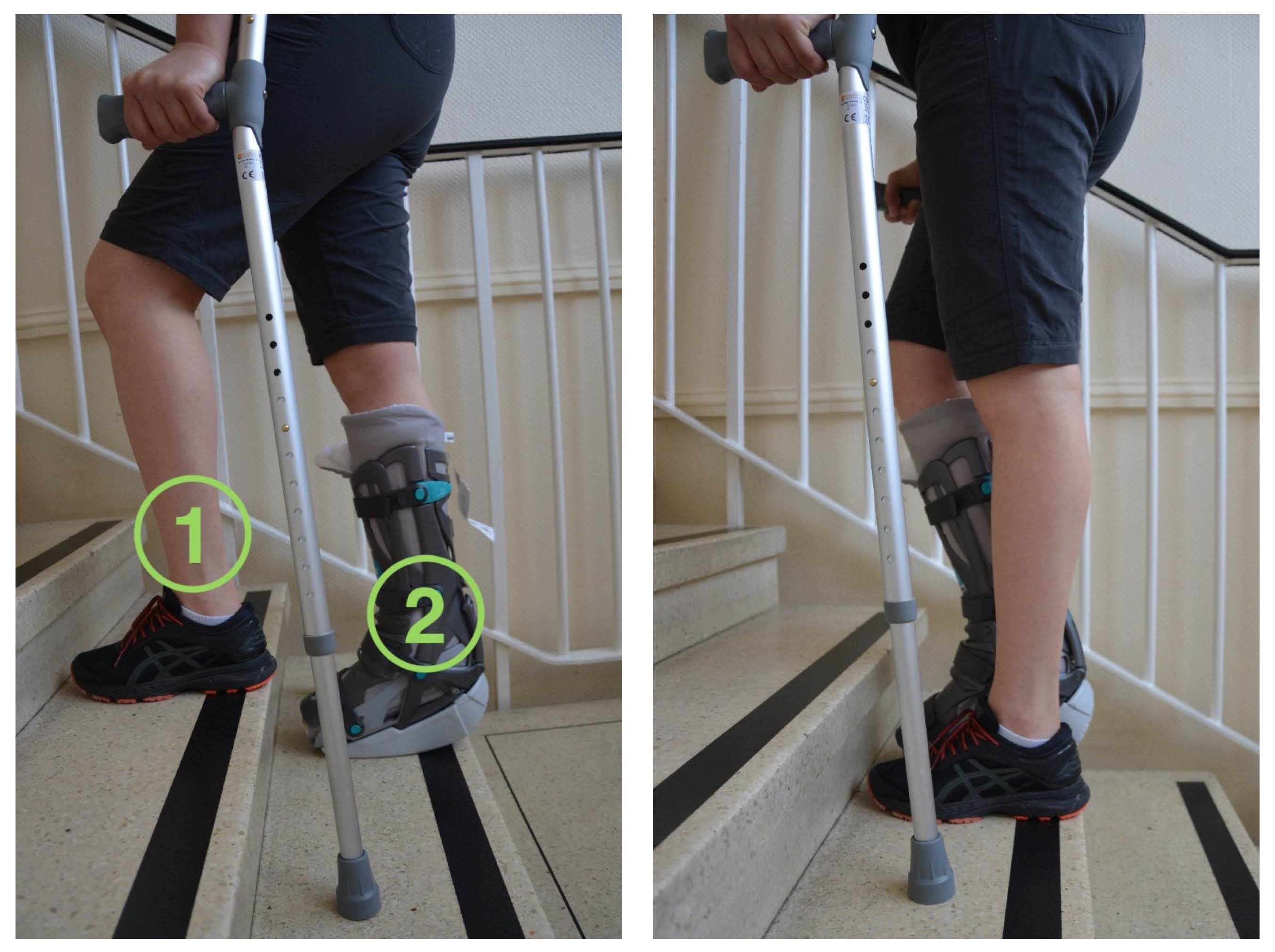 When going up the stairs, start with your non-affected leg first (1), follow with the affected leg (2) and then the crutches.