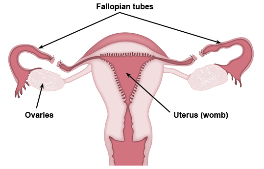 Diagram showing the reproductive organs, and the removal of a piece of each fallopian tube