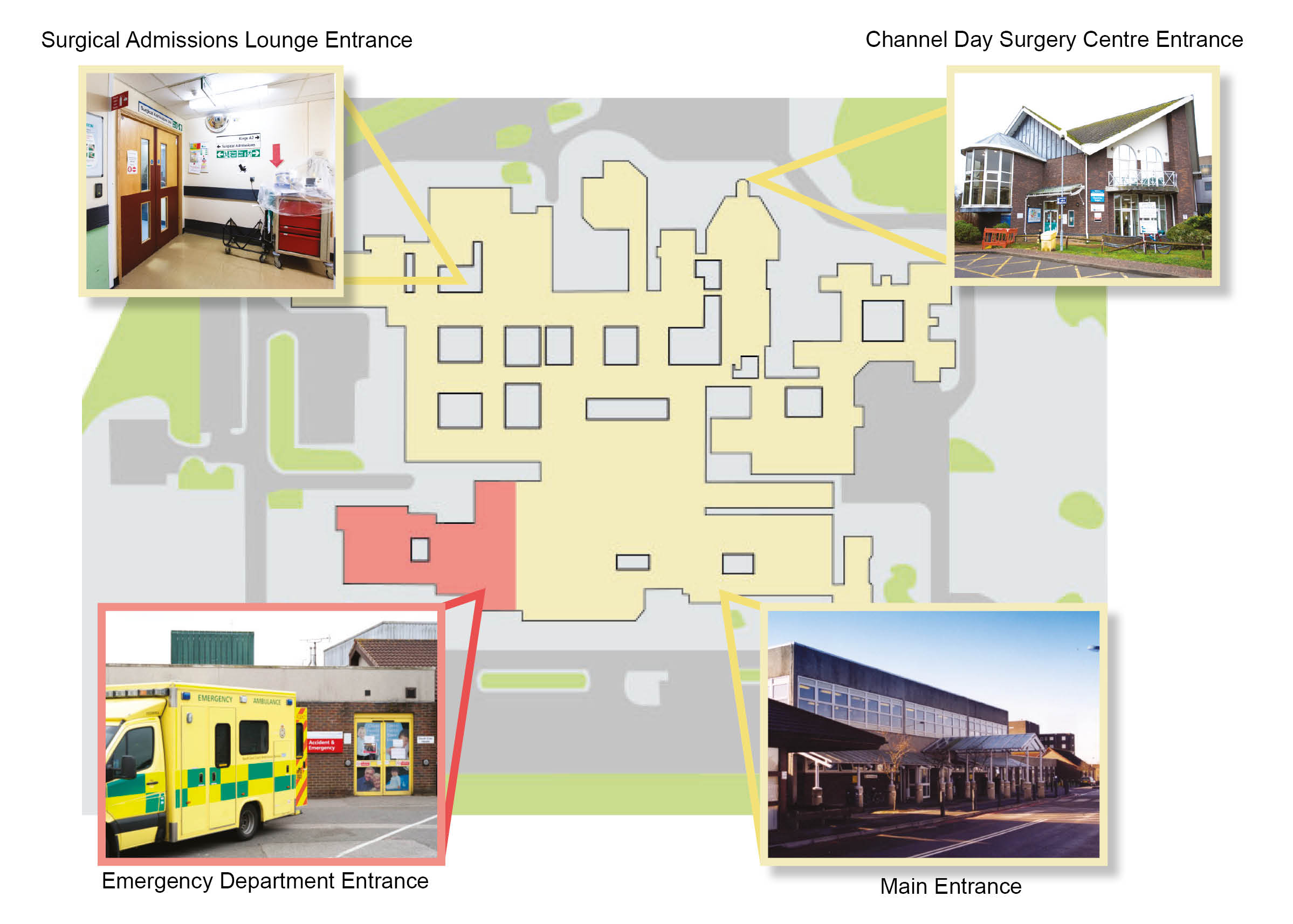 Map showing entrances to the Channel Day Surgery Unit and the Channel Day Surgical Admissions Lounge