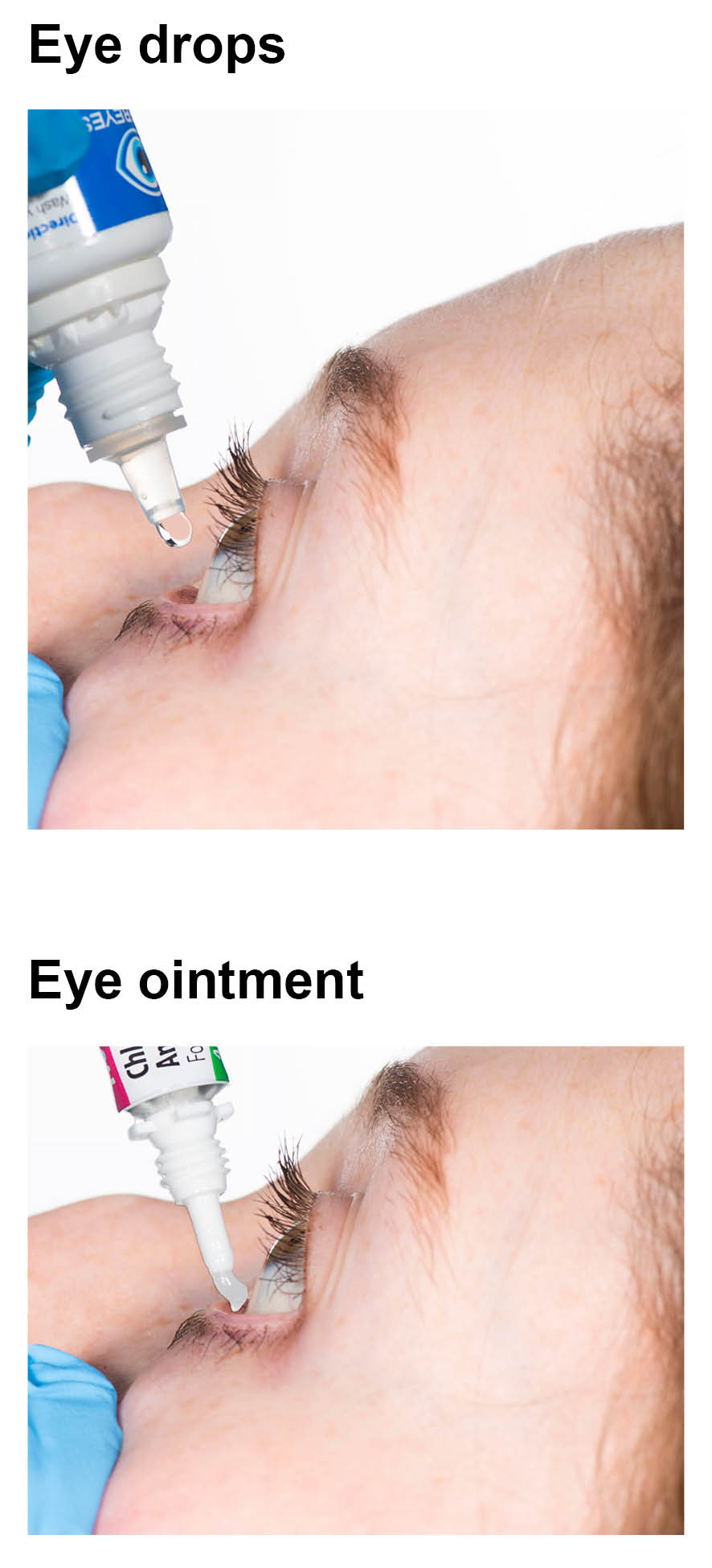 Tilting the head back slightly, and pulling down the lower eye lid. Squeeze the drops / ointment into the space between the eye and lower eye lid.