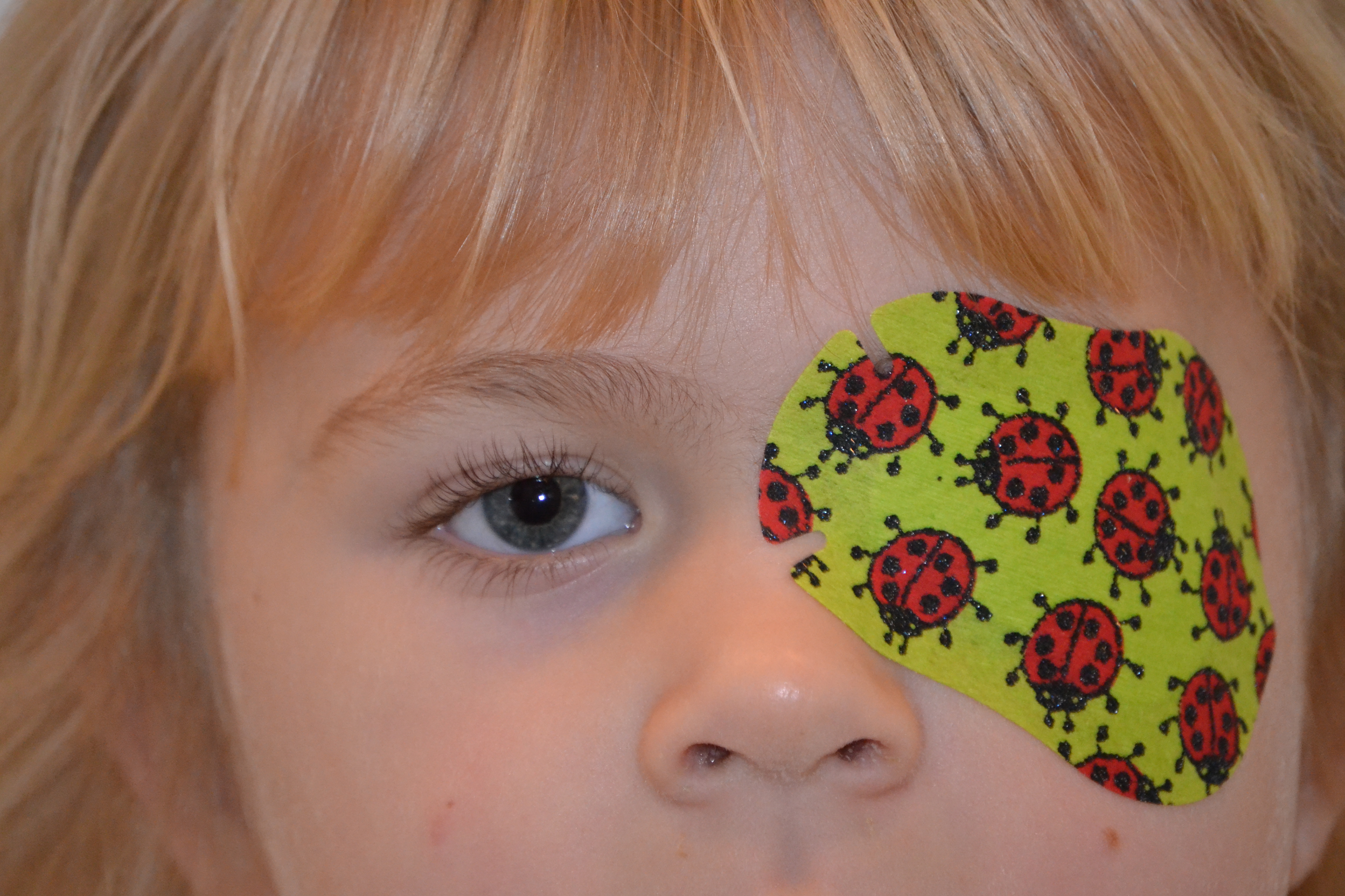 A child wearing a patch with drawings of ladybirds on, and no glasses