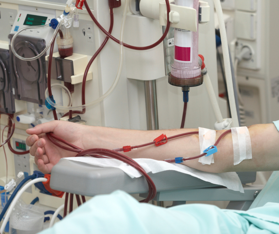 Haemodialysis being given through the arm