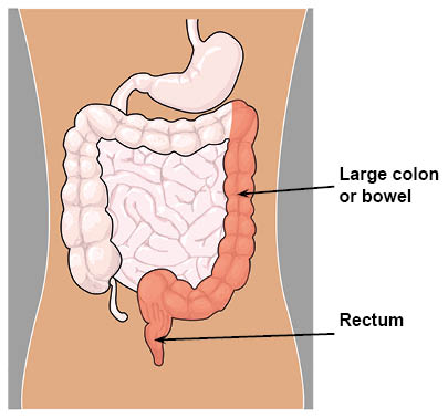 Diagram highlighting the large colon or bowel and rectum