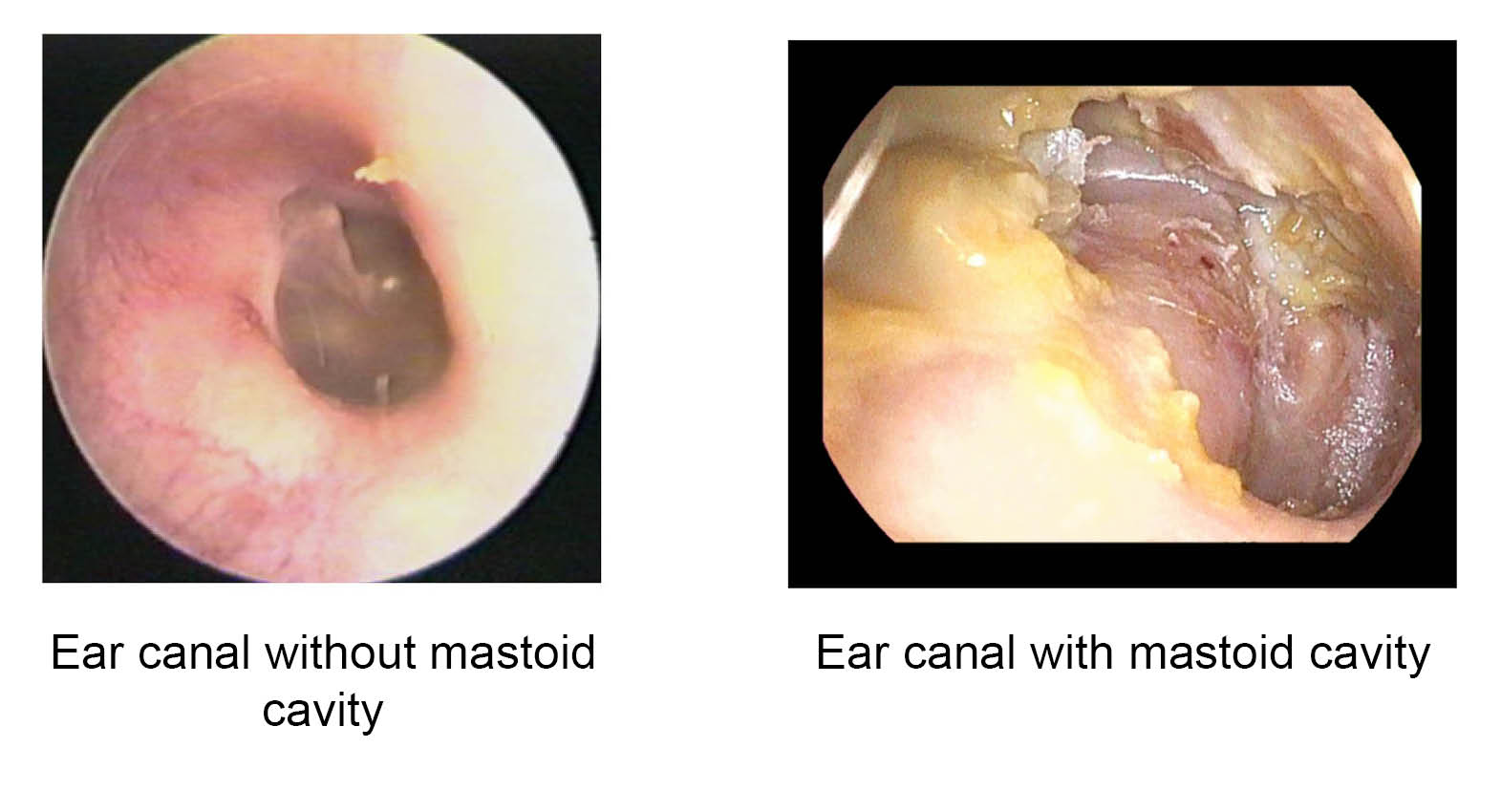 masoid-cavity-comparison-1723212617.jpg