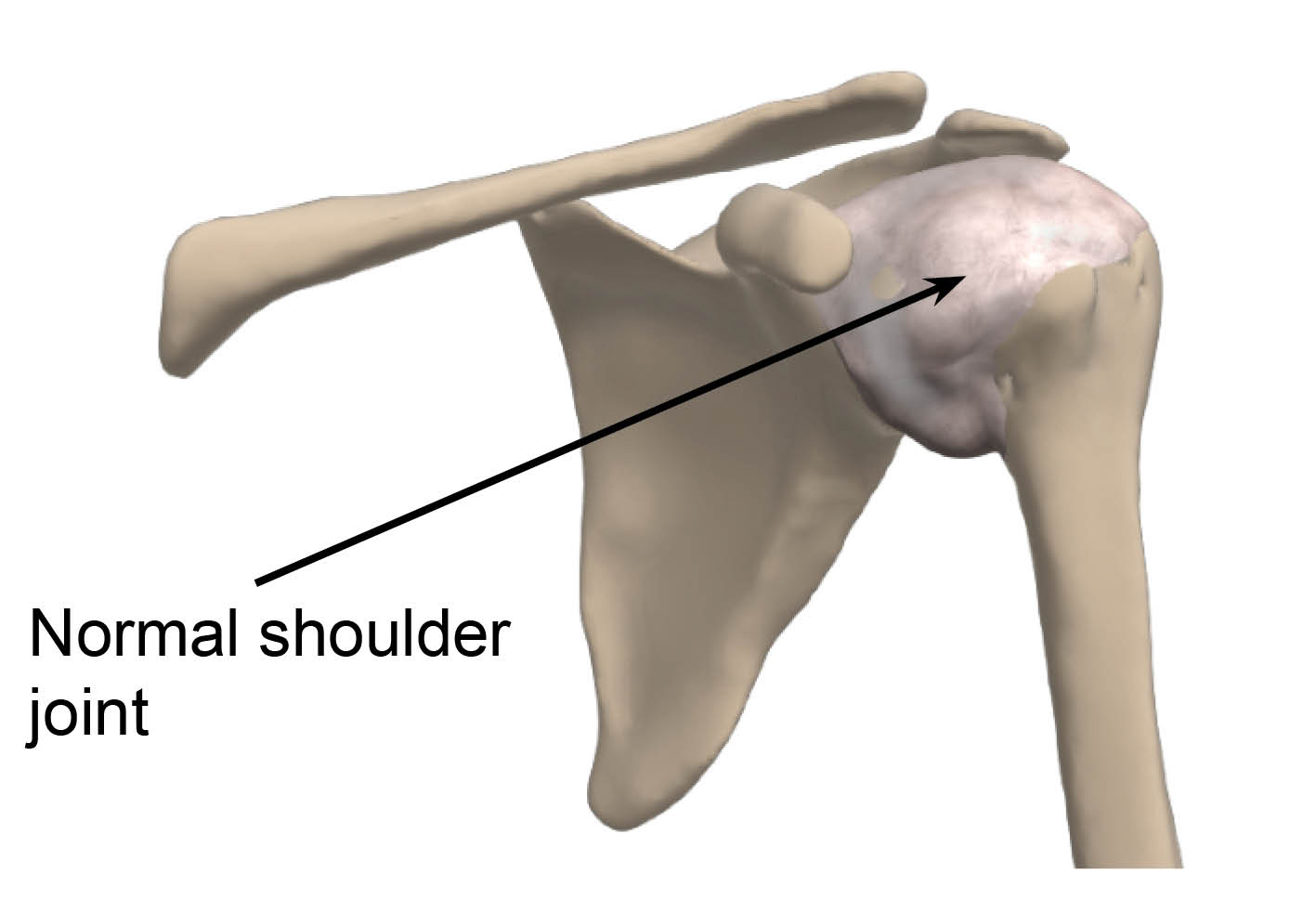 Normal shoulder joint (not inflamed)