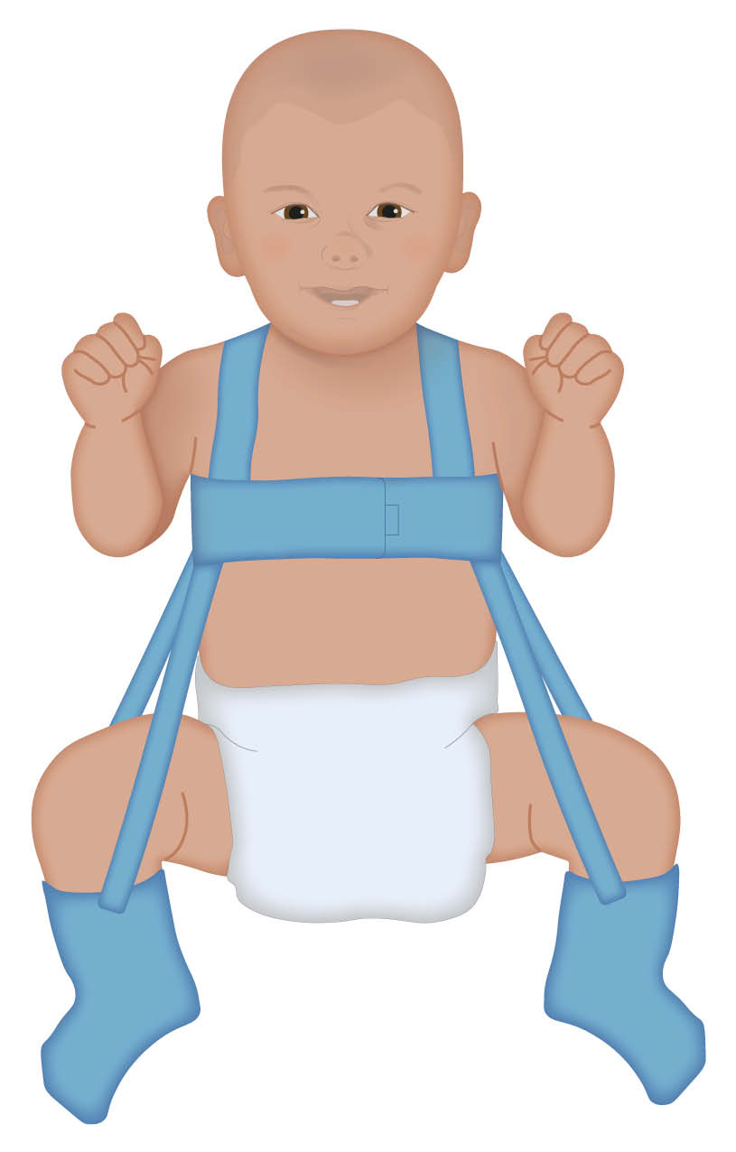 Photo of a baby in Pavlik Harness