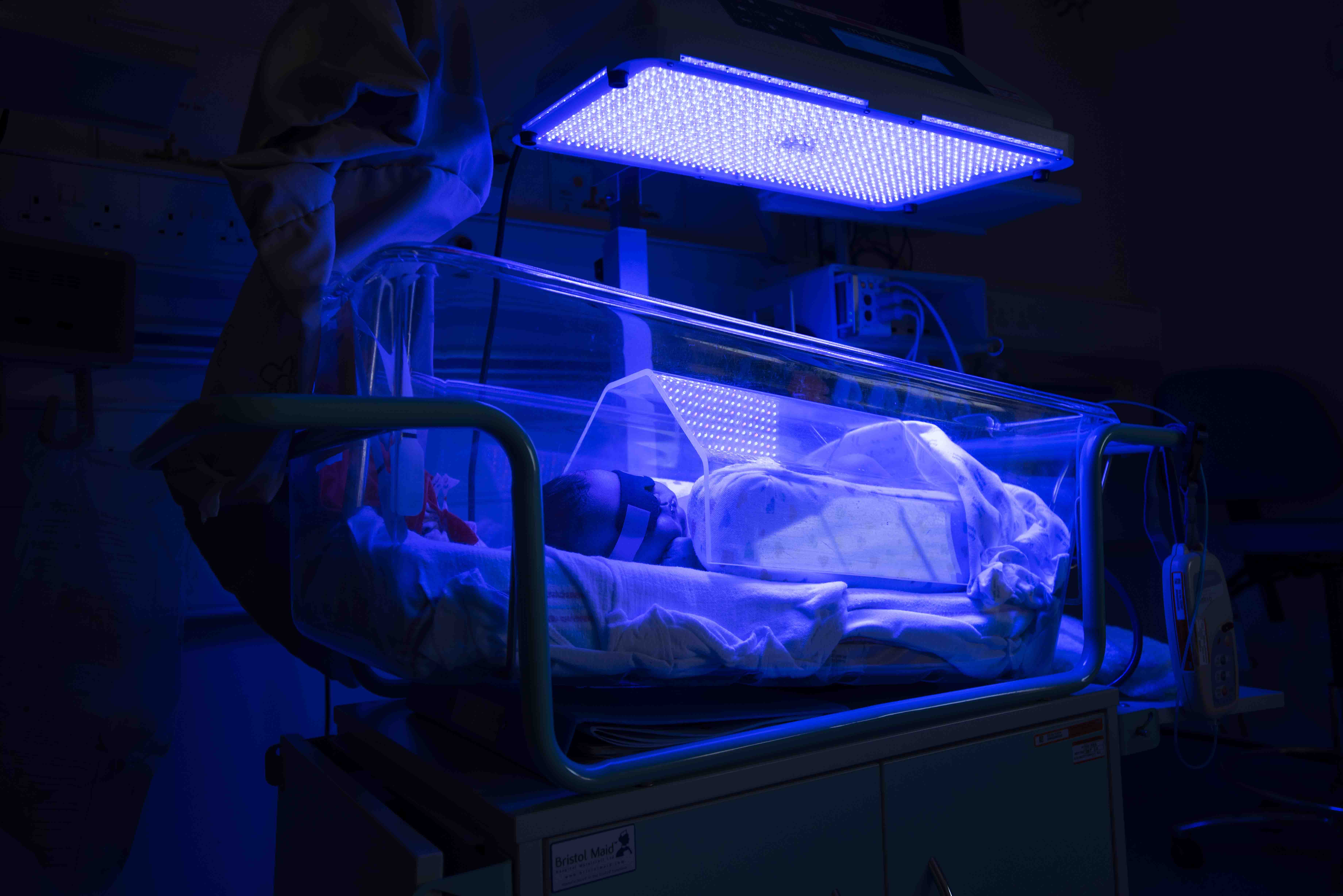 Photo of a baby having phototherapy