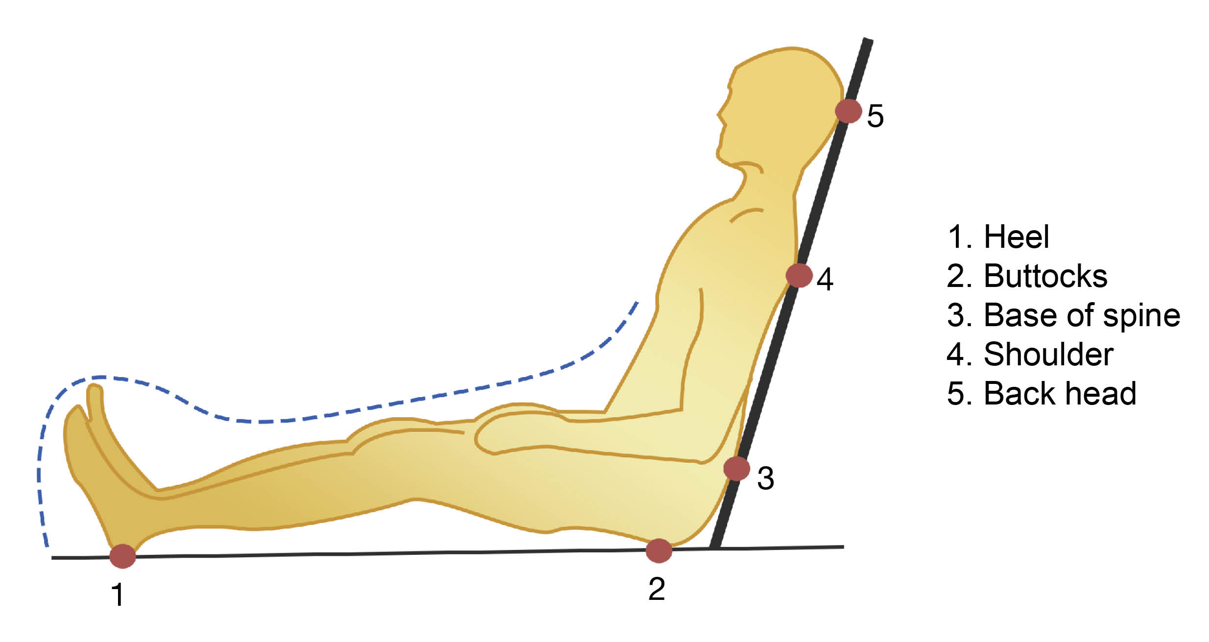 When sitting, the points on the body where a patient is at risk of developing a pressure ulcer