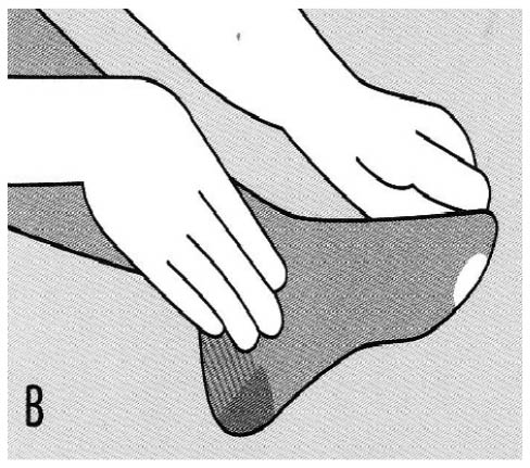 Diagram showing a patient smoothing out any excess material causing creases at the foot, by pulling the open toe section of the stocking forward