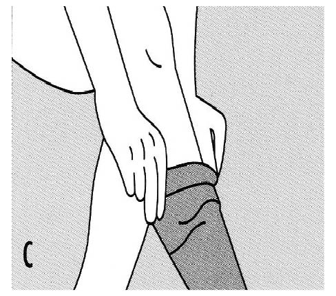Diagram showing a patient pulling the stocking up over their calf, making sure they smooth out any wrinkles that appear, and that the band at the top is smooth and not rolling over