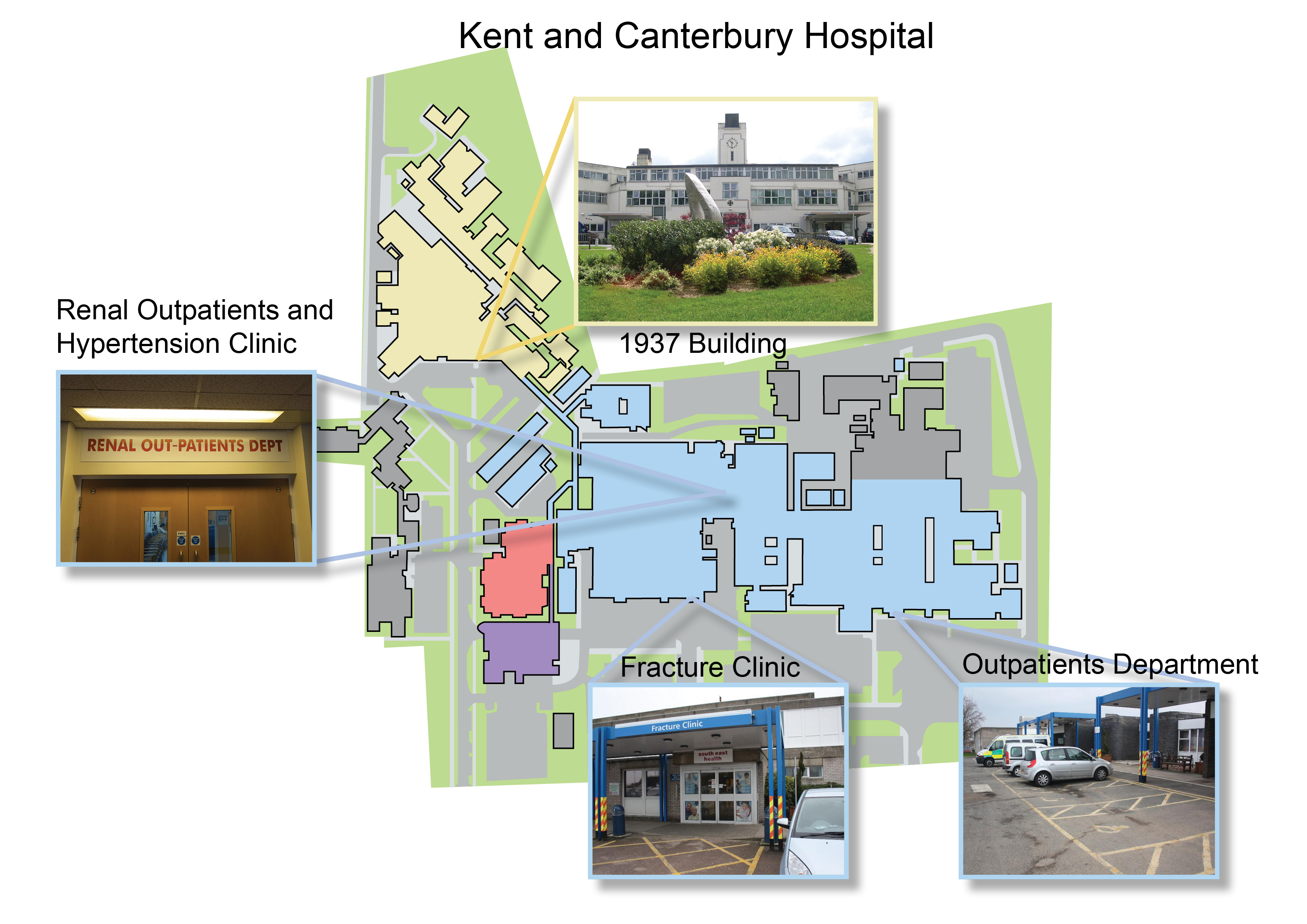 Map showing location of Renal Outpatients and the Hypertension Clinic at Kent and Canterbury Hospital