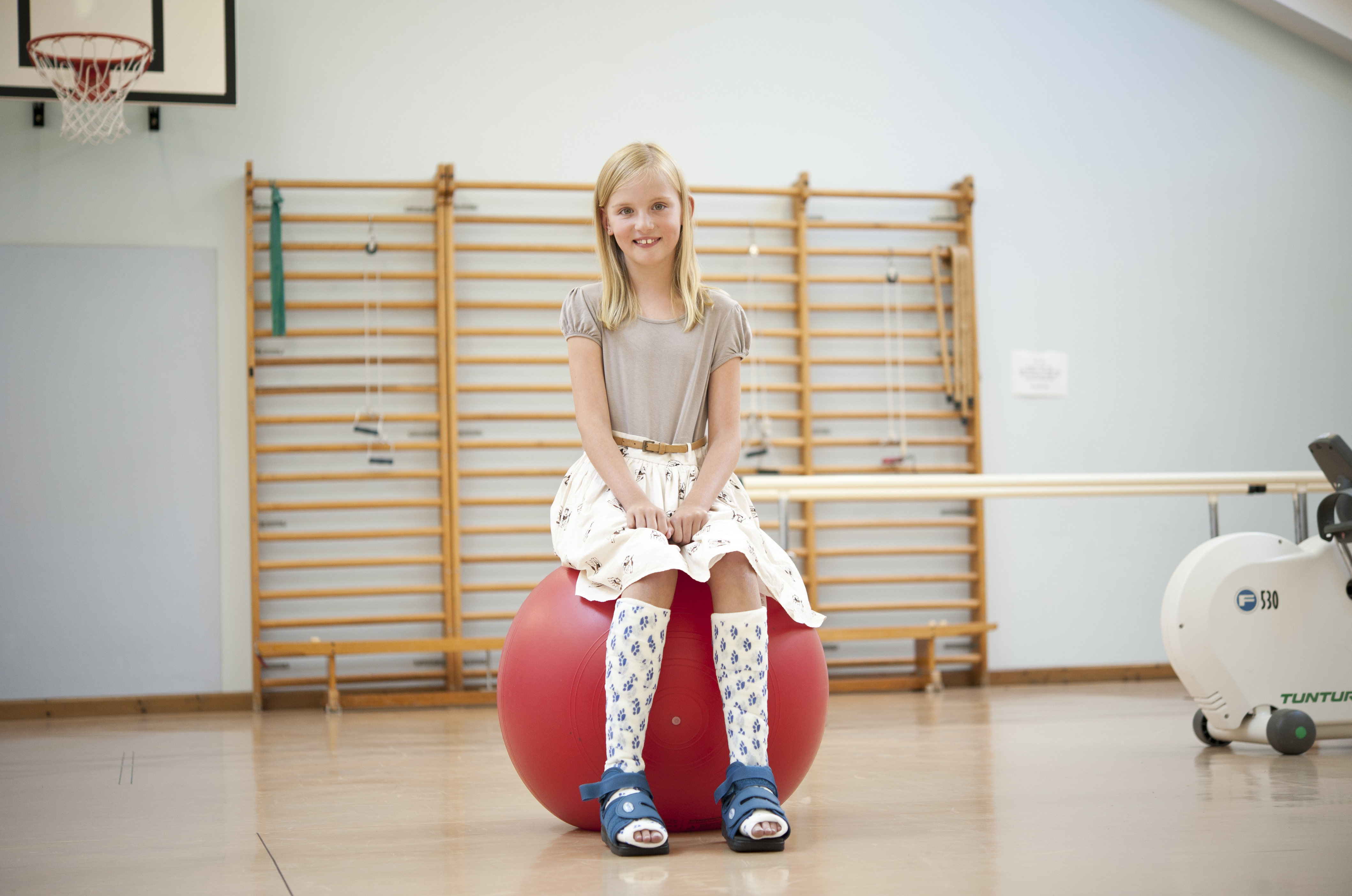 Photo of a child with plaster on both legs sitting on a large exercise ball