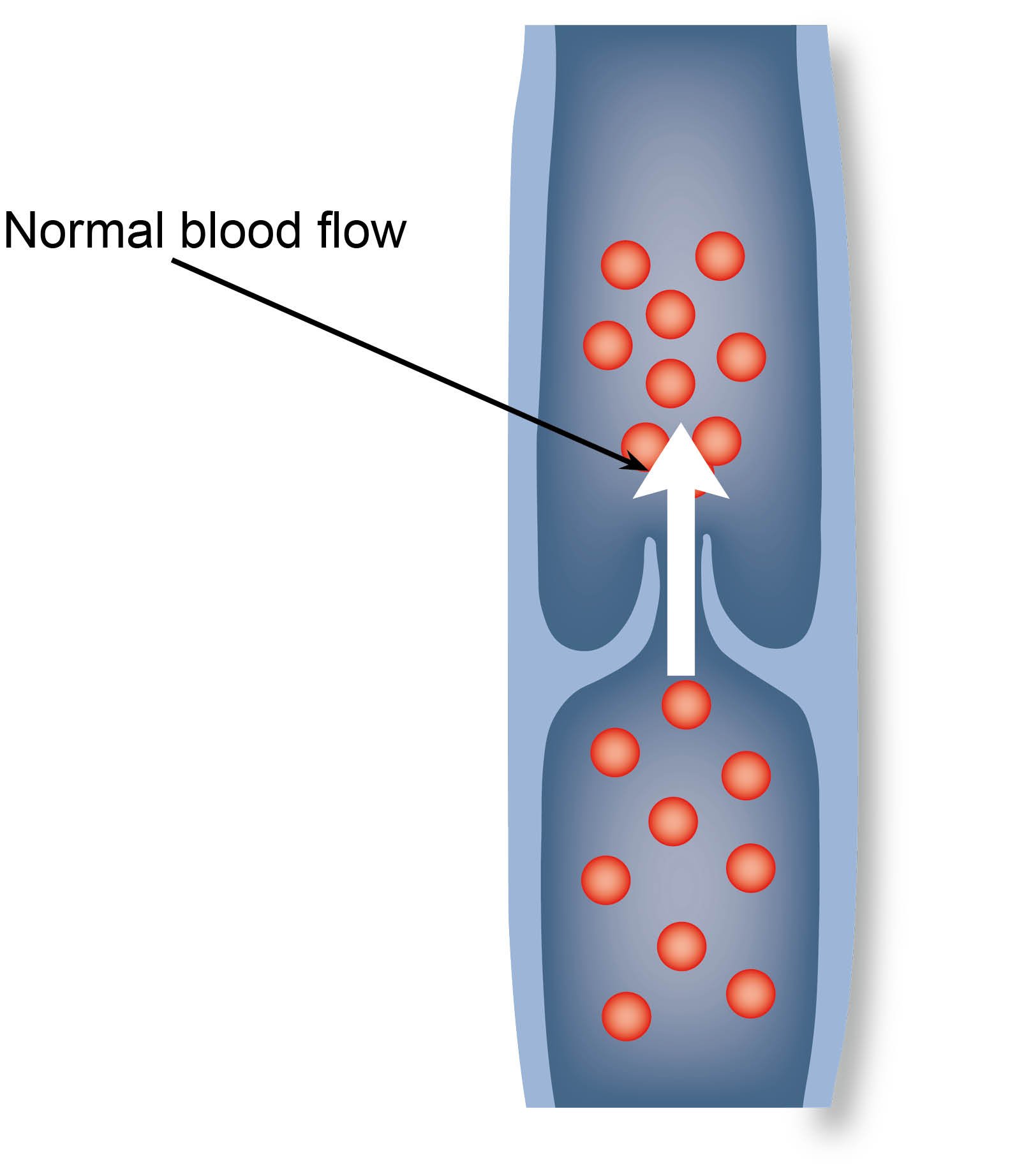 varicose-vein-normal-blood-flow.jpg