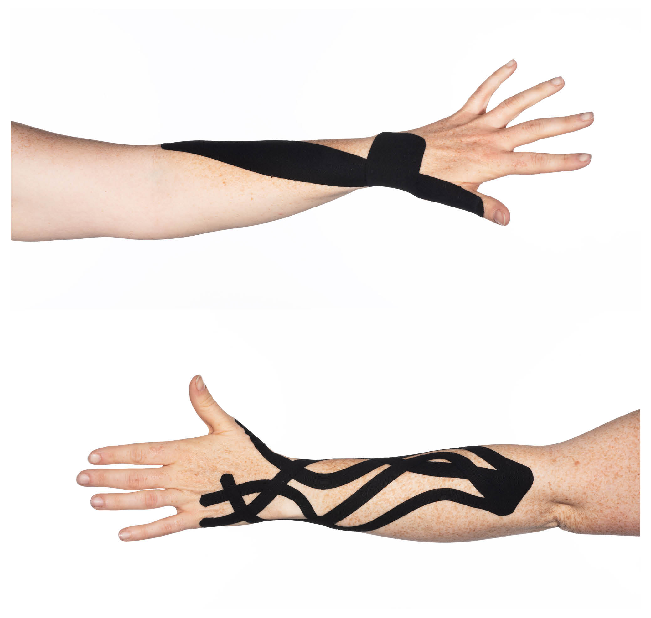 Black kinesio tape strapped on the lower part of the arm and the wrist.