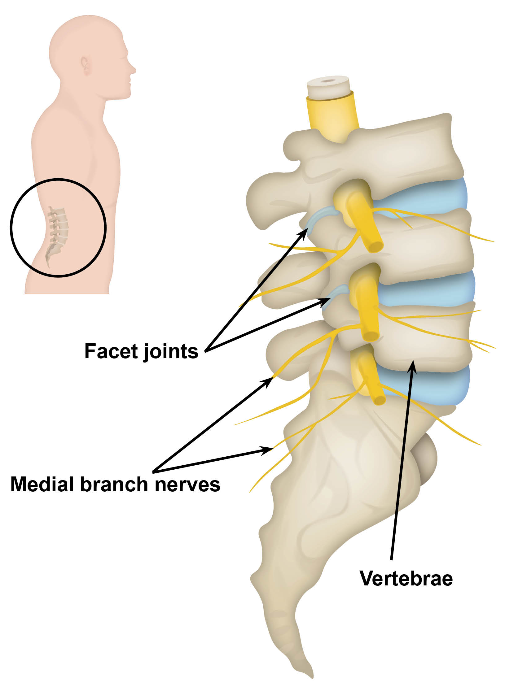 Facet joints and medial branch nerves in the base of the spine