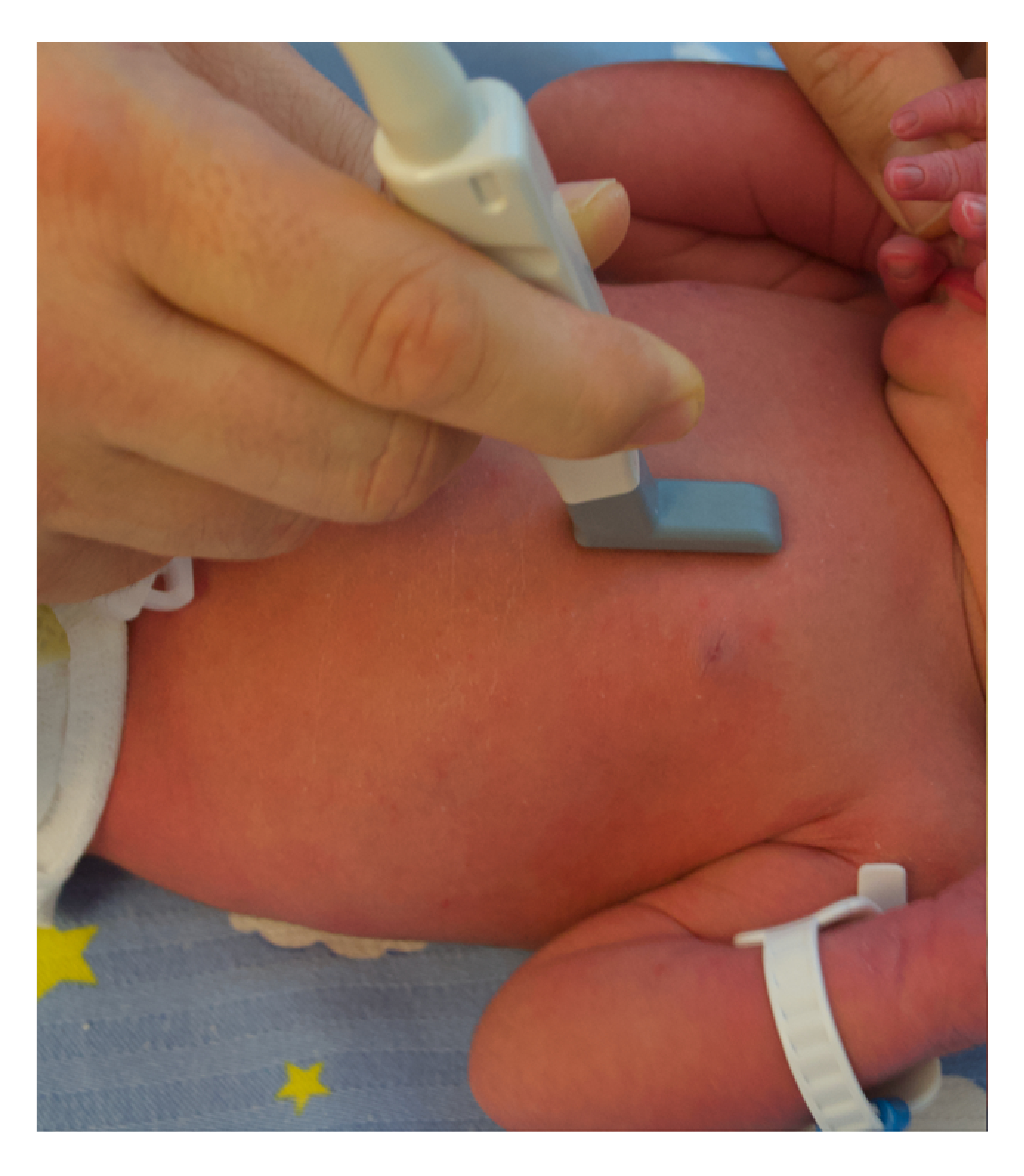newborn-ultrasound-(2).jpg