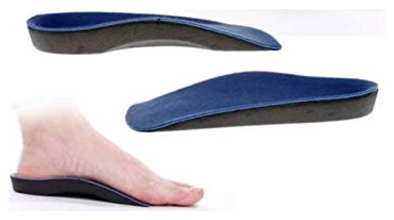 Example of a shoe insole