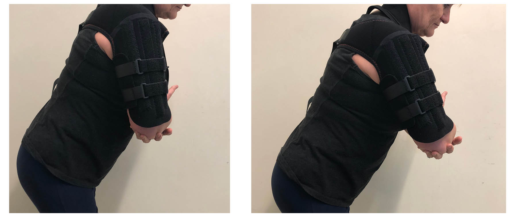 Lean forward, bending slightly at your waist. Hold your injured arm across your body, and support your injured elbow with your other hand. Gently move your arm away from your body and then back again.