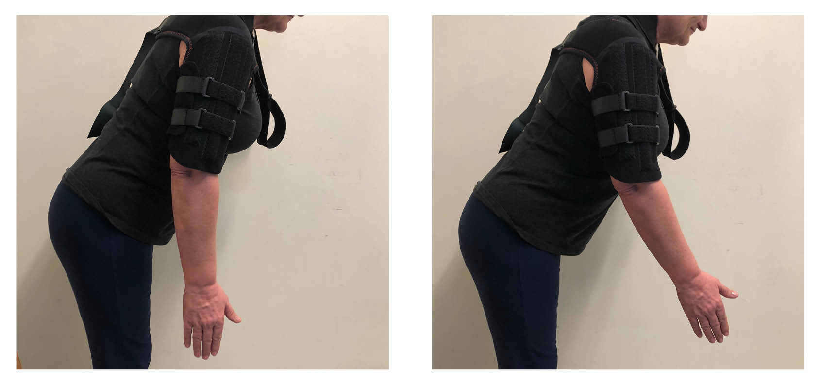 Lean forward, bending slightly at your waist. Hang your injured arm down, so your fingers are pointing to the ground. Gently move your arm away from your body, keeping your arm straight. Move it back again.