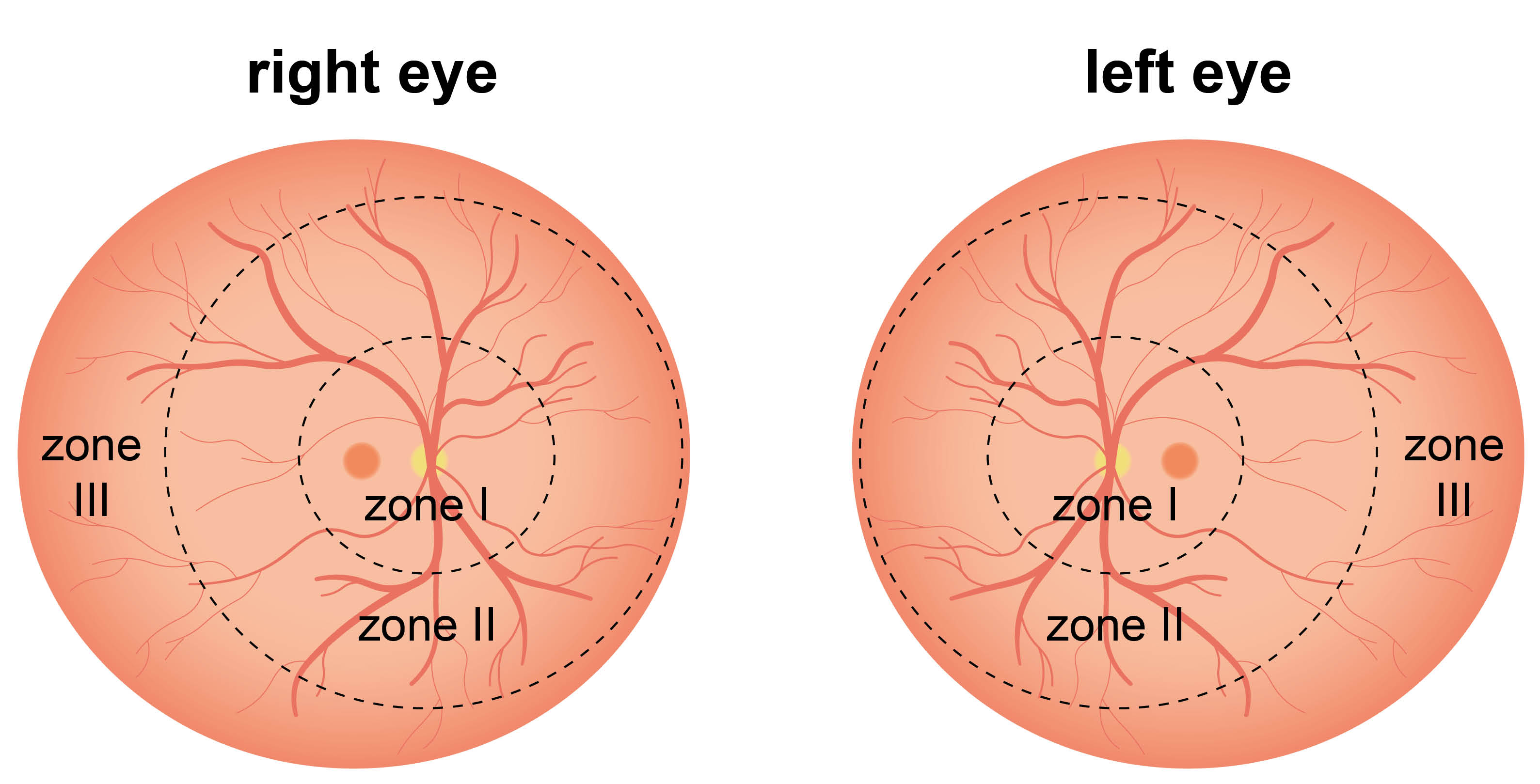 rop-right-and-left-eye-zones.jpg