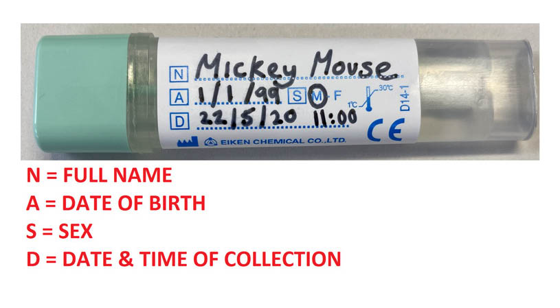 Sample bottle with full name, date of birth, sex, and date and time of collection on label